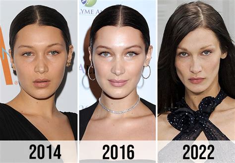 bella hadid weight loss.